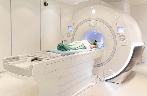 MRI trong chẩn đoán đột quỵ